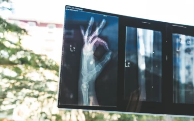 Bone Health and Eating Disorders